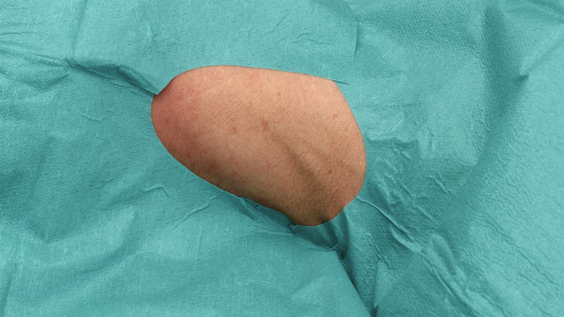 Lochtücher selbstklebend 50 x 60 cm - Packung à 100 Stück