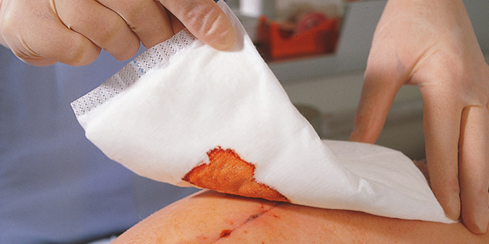 Zetuvit® steril in 10 x 10 cm, 1 Faltschachtel à 25 Stück