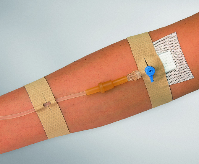 Curafix® i.v. classic 12,5 x 2,5 cm - 20 Stück