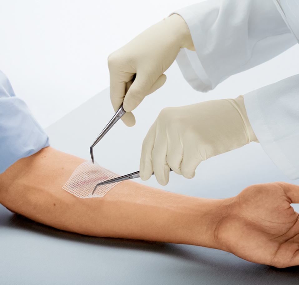 Cuticell Classic Salbenkompresse 10 x 10 cm - Packung à 10 Stück